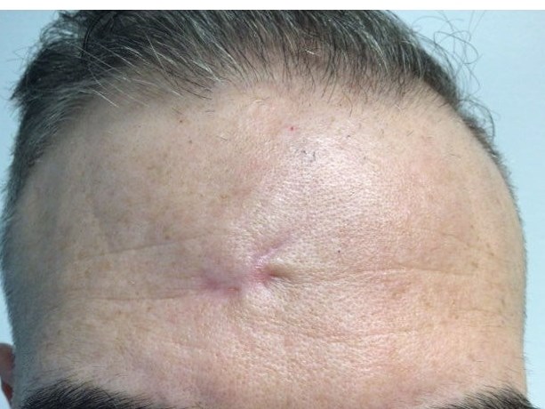 Before Image