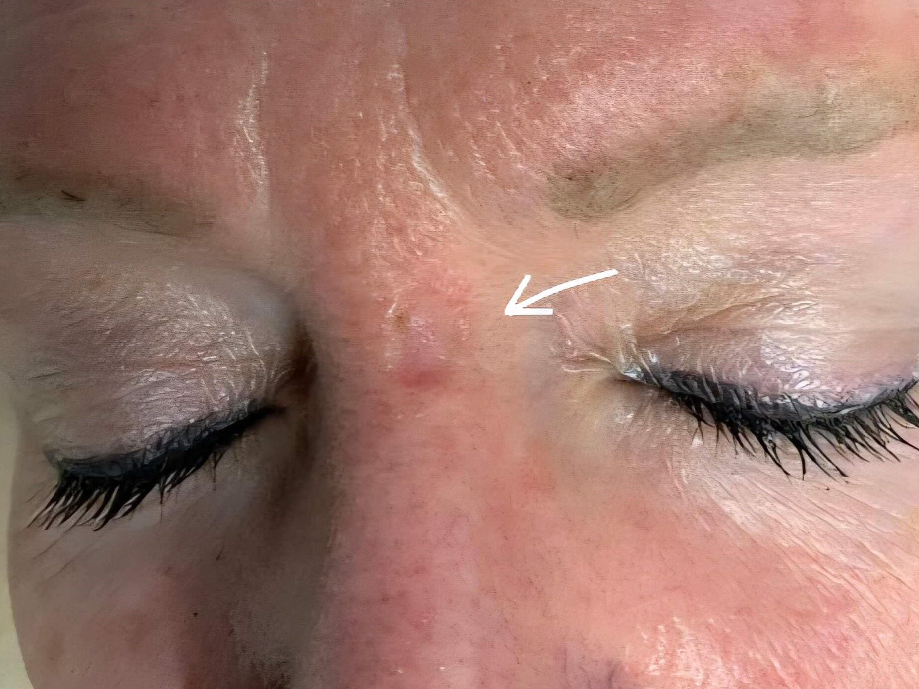 Before Image