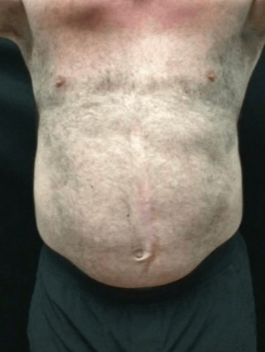 Before Image