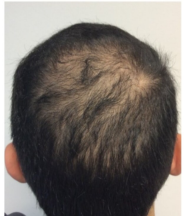 Before Image