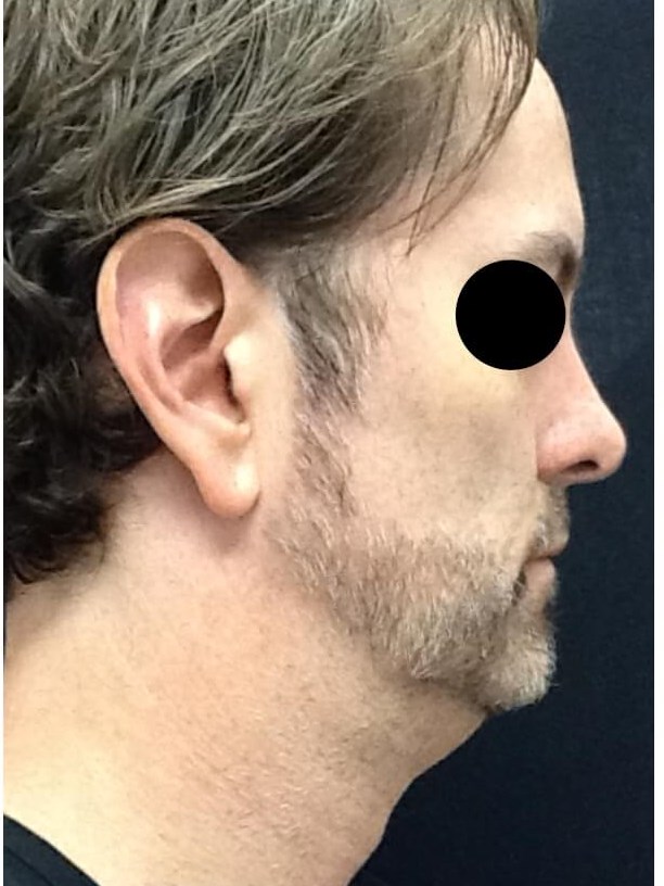 Before Image