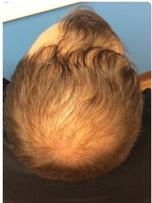 Before Image