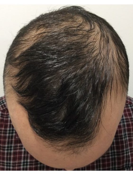 Before Image