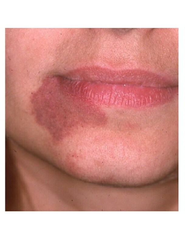Before Image