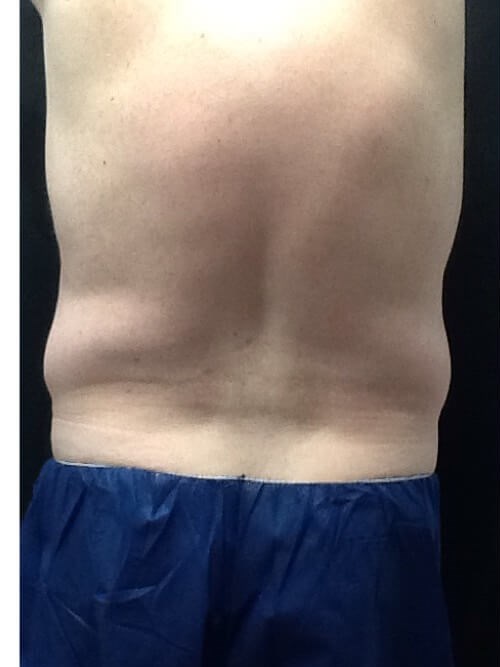 Before Image