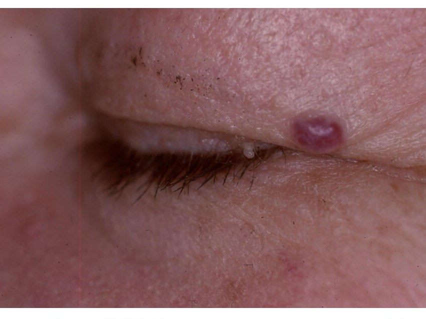 Before Image