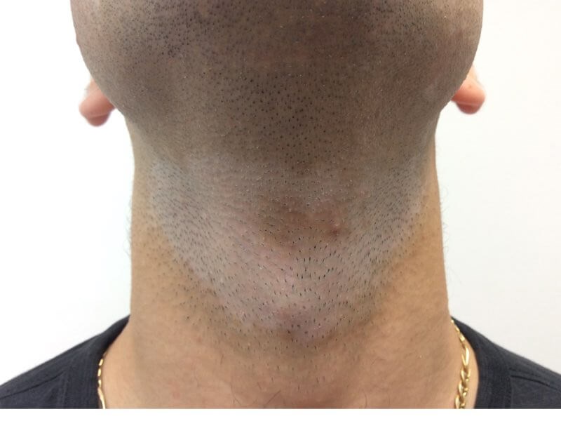 Before Image