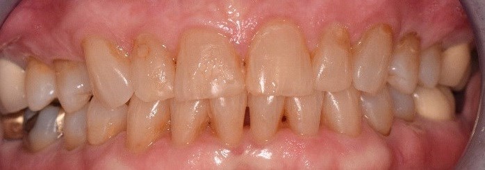 Before Image