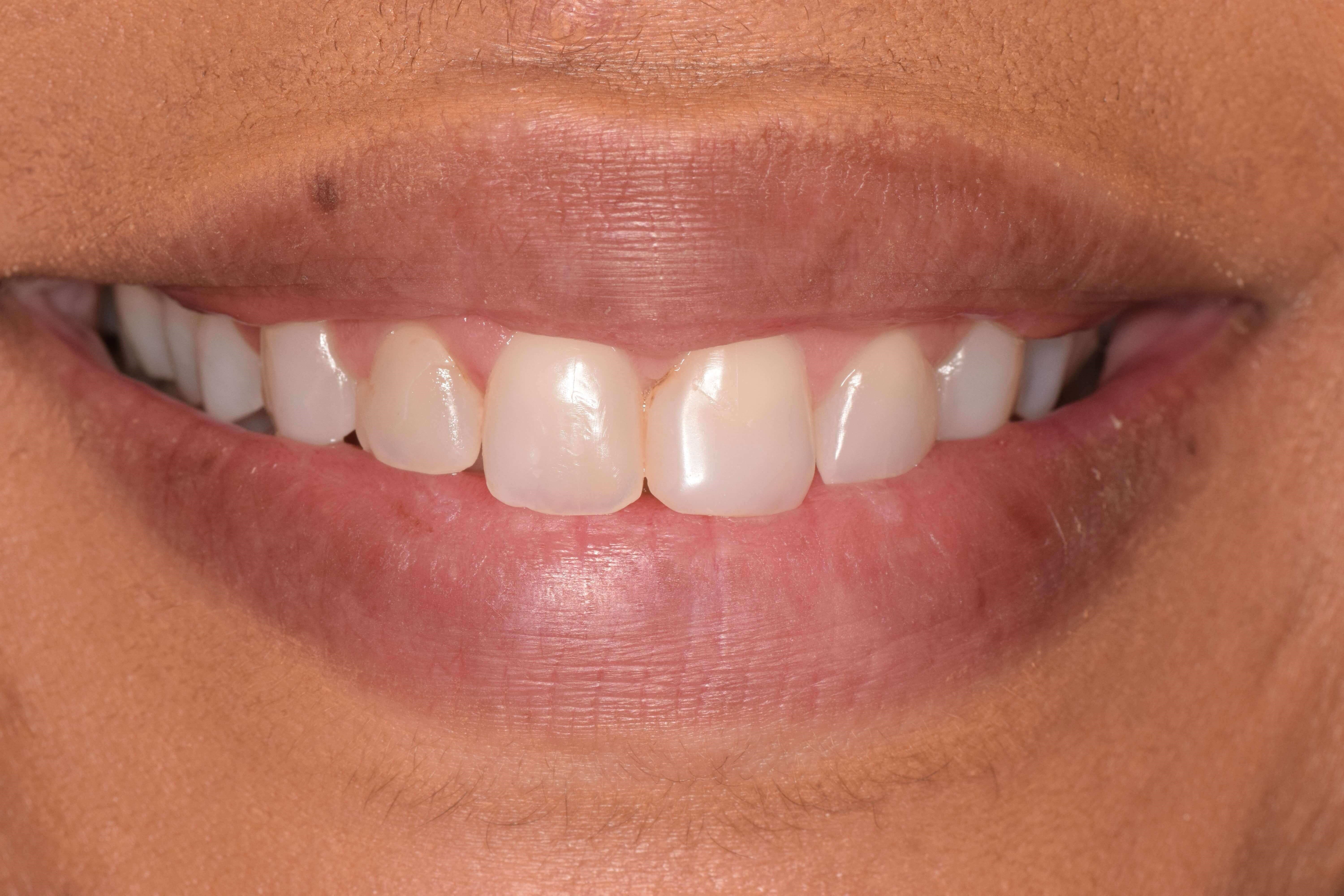 Before Image