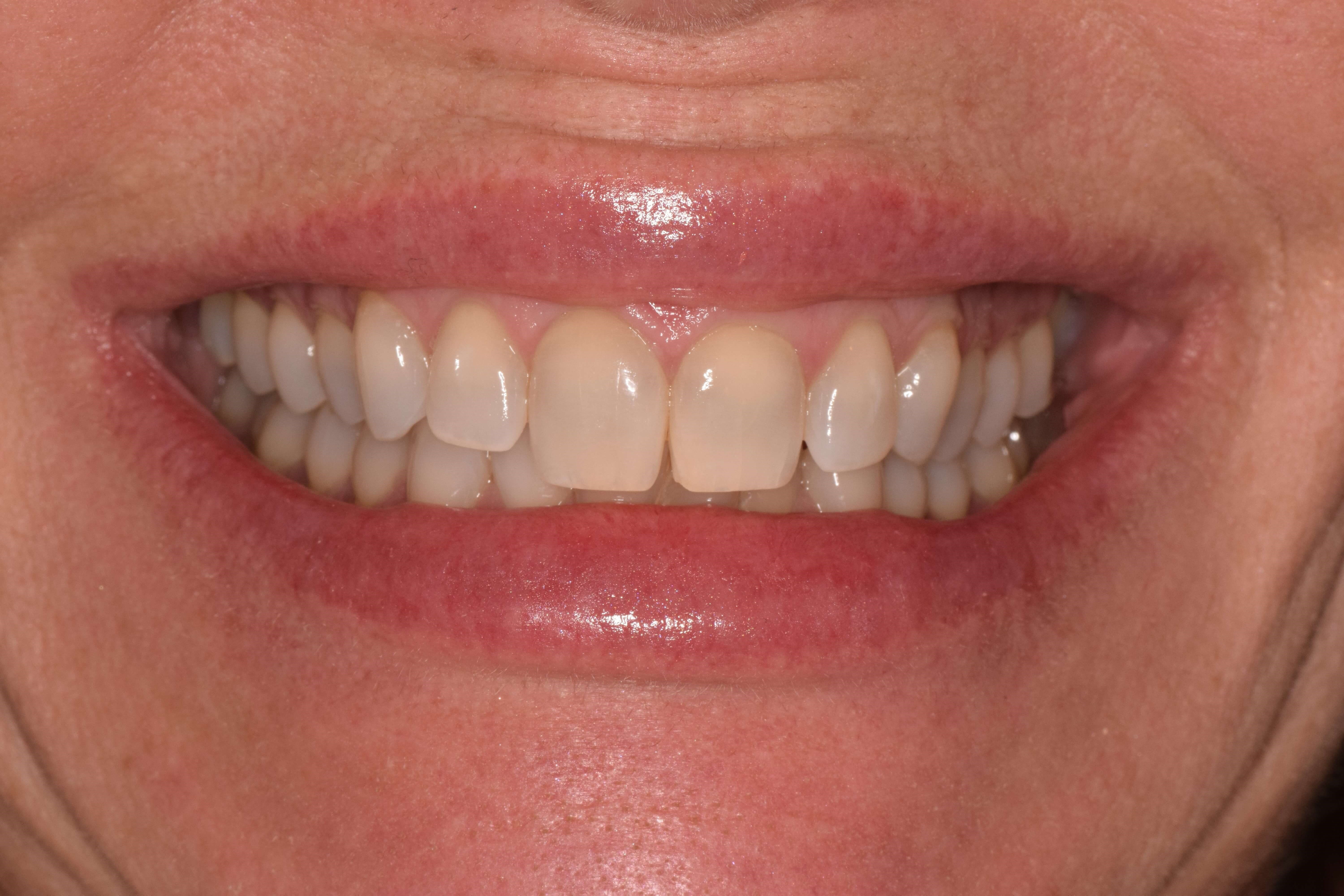 Before Image