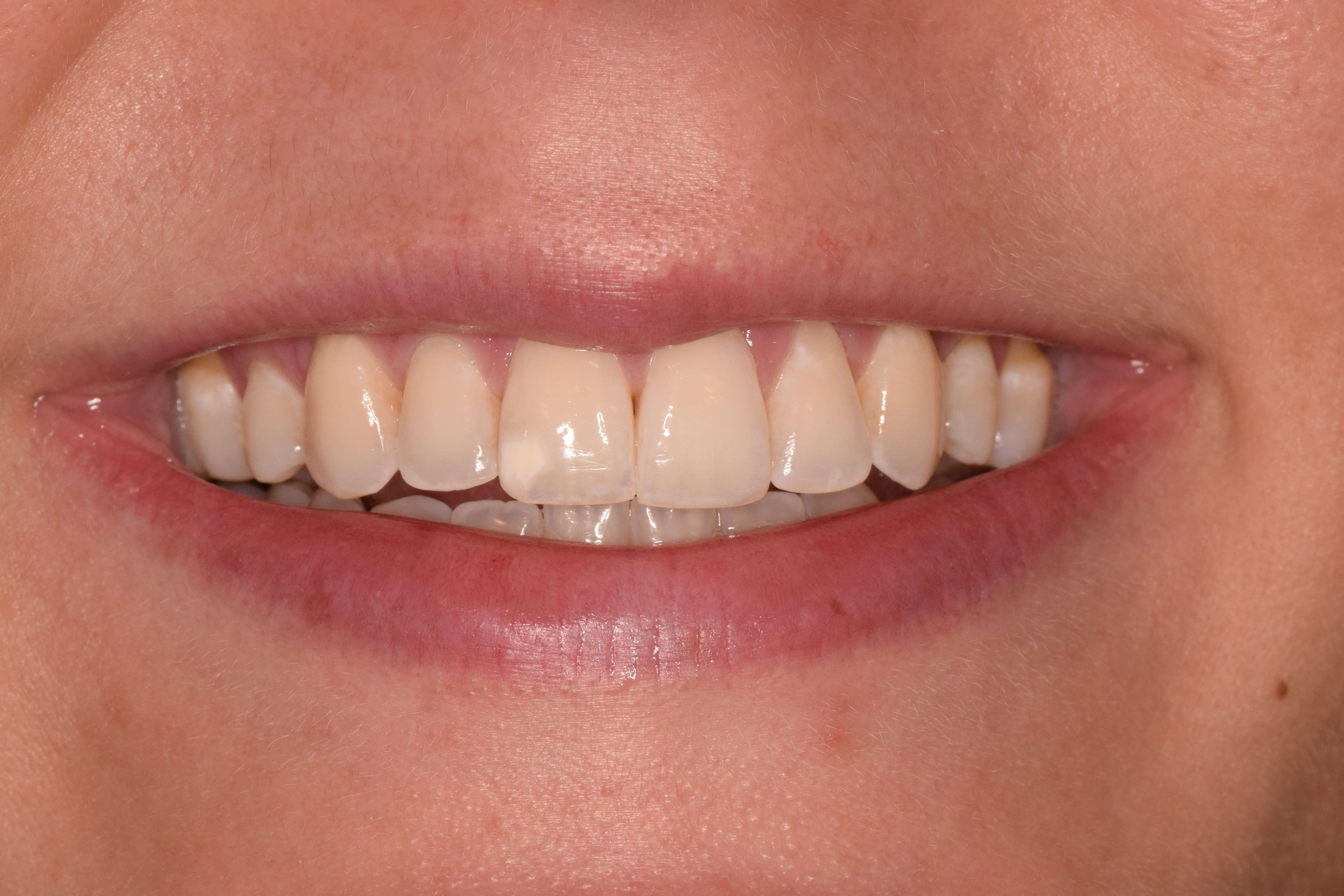 Before Image
