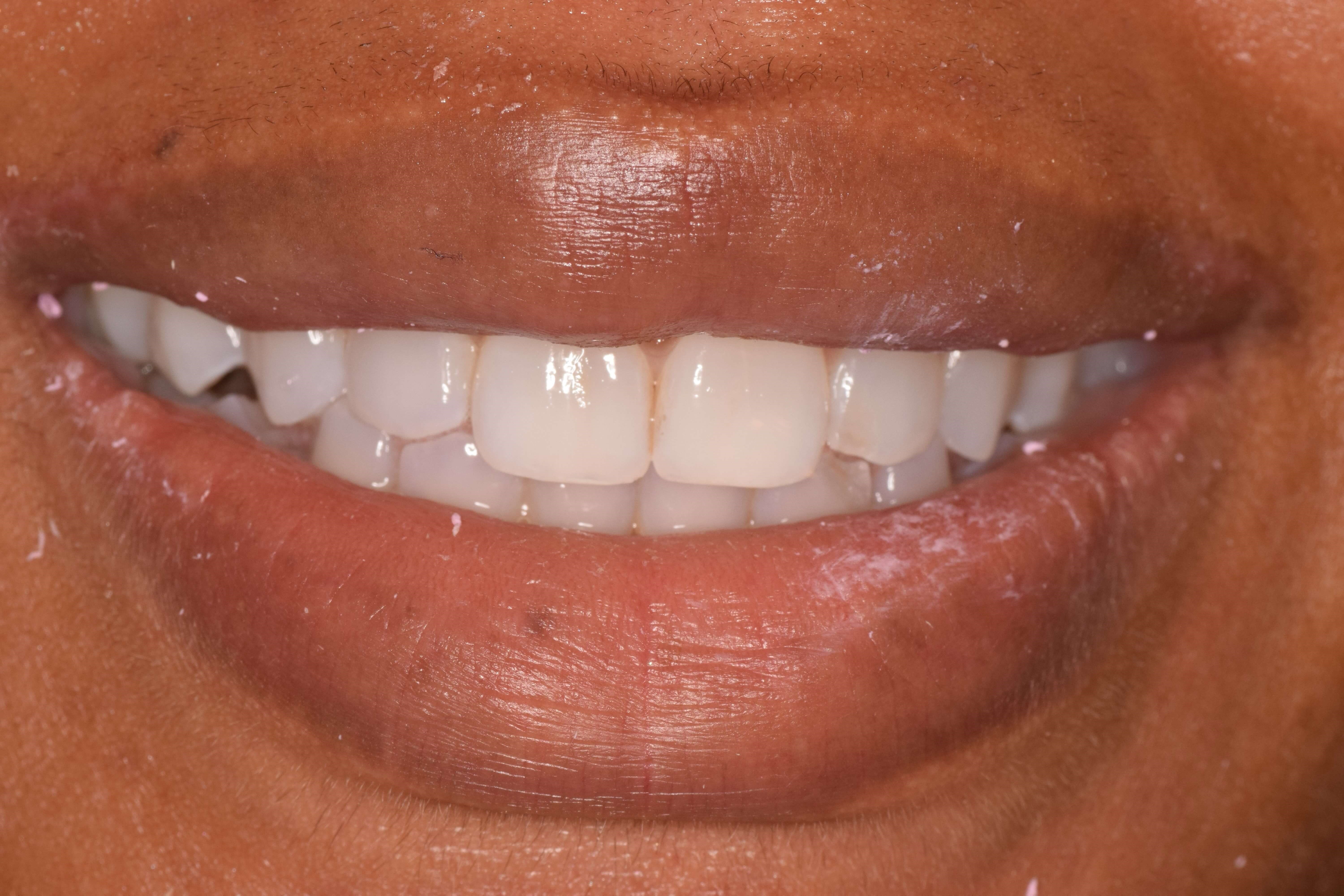 Before Image