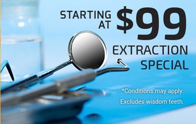 Extraction Special