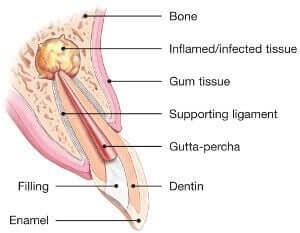 Procedure