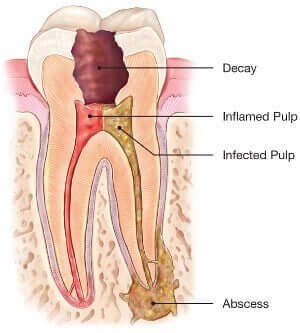 Procedure