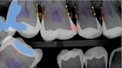 Modern Dental Imaging That Helps You Understand Your Care