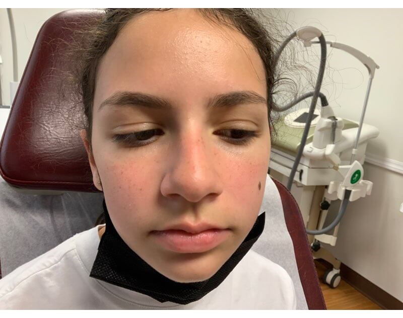 After Image