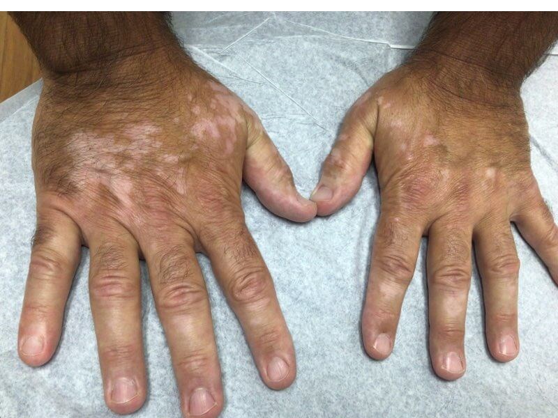 Hands Before