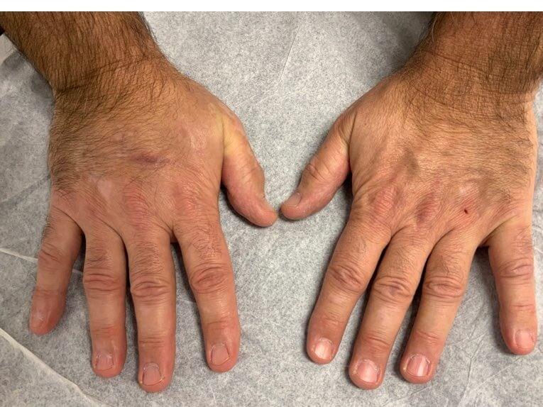 Hands After