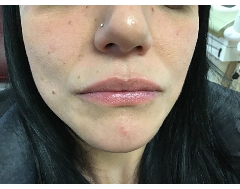Before Image