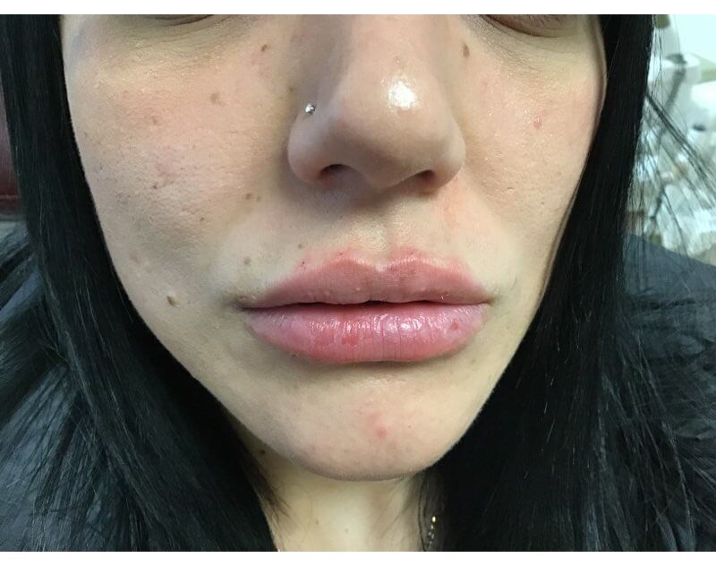 After Image