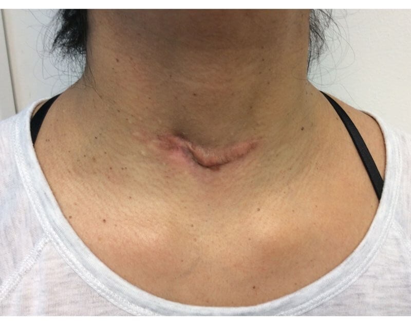 Neck Before