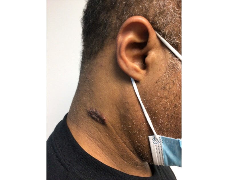Neck Before