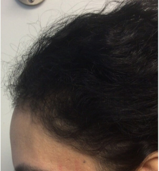 Side View After