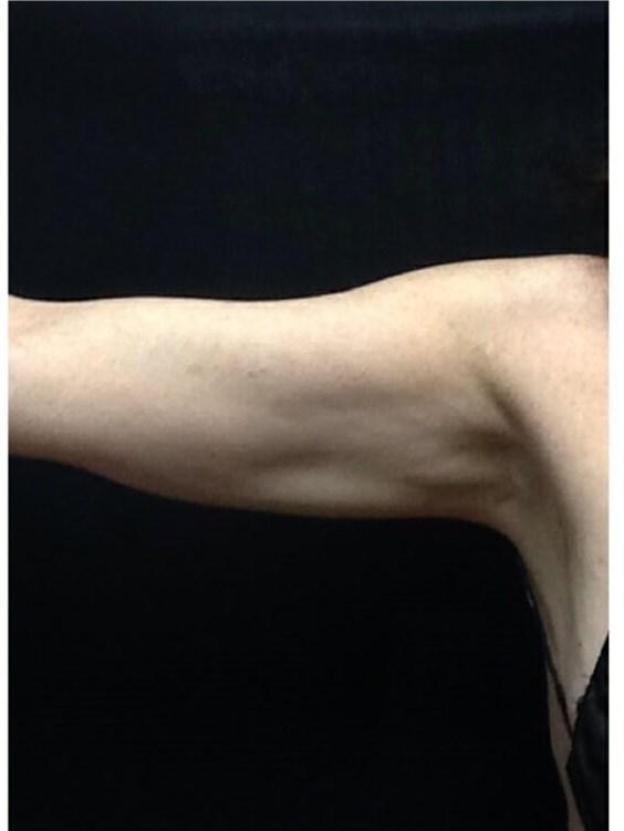 Arms After