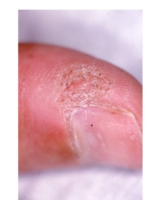Finger Before