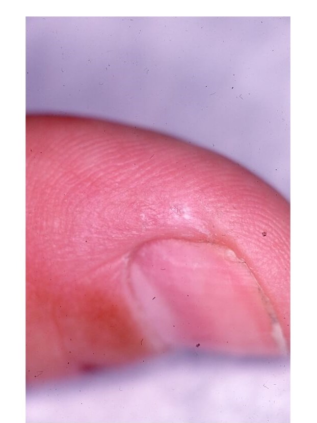 Finger After