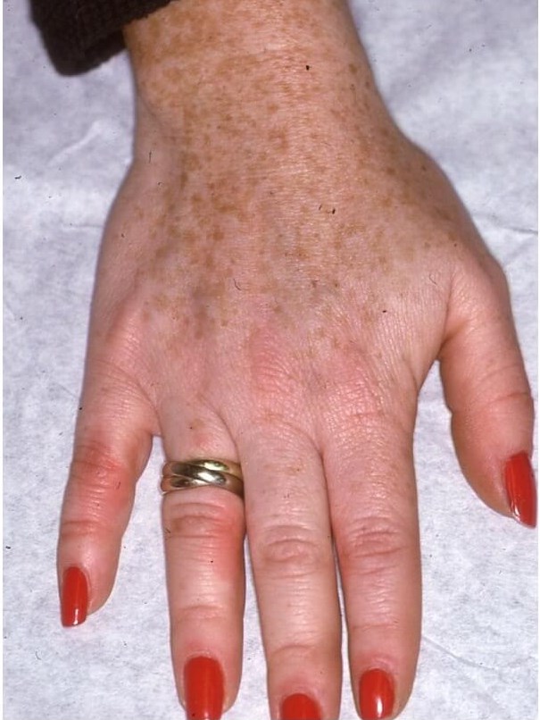 Hands Before