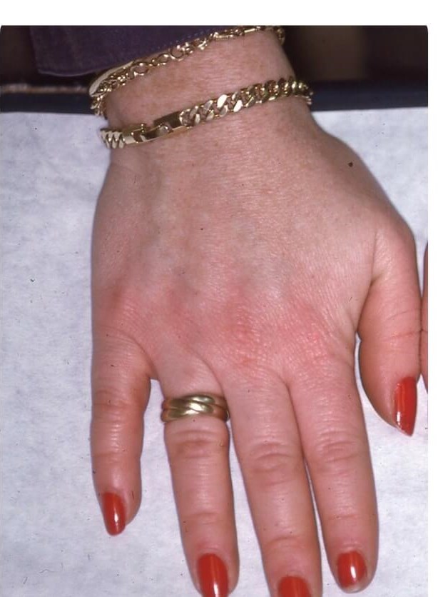 Hands After