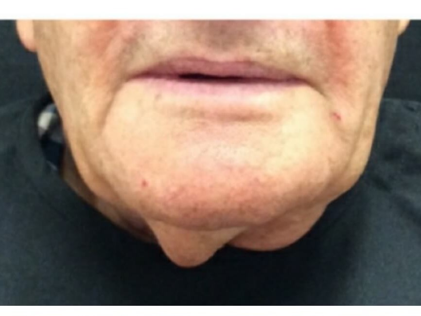 Neck Before