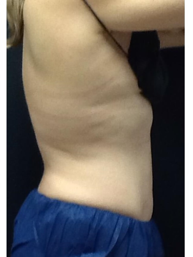 Stomach After