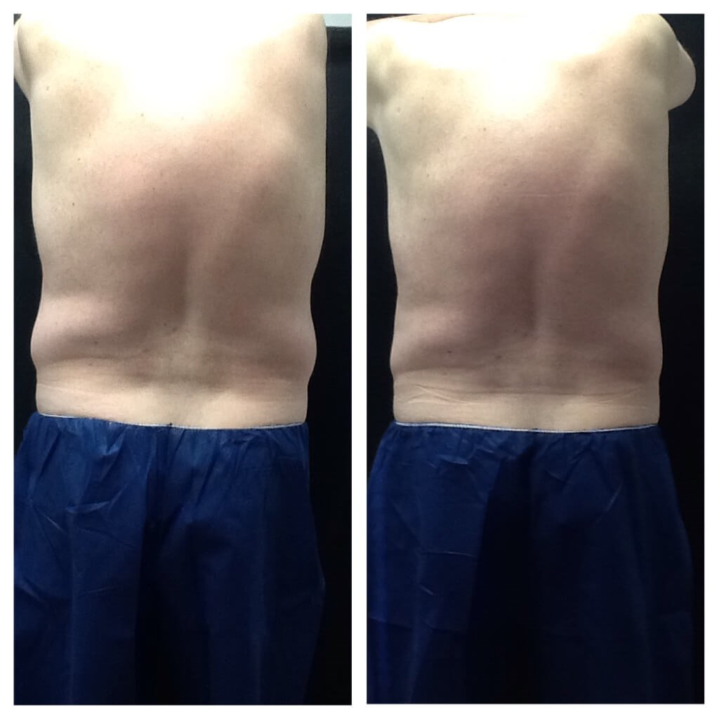 Before Image