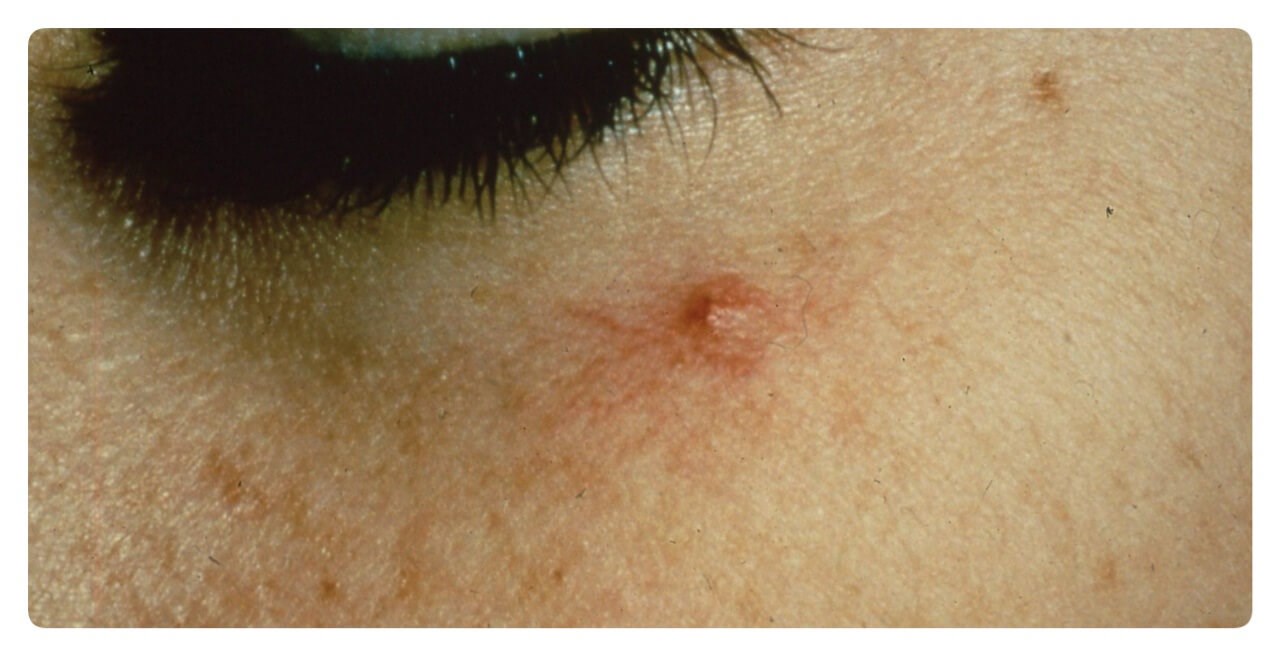 Before Image