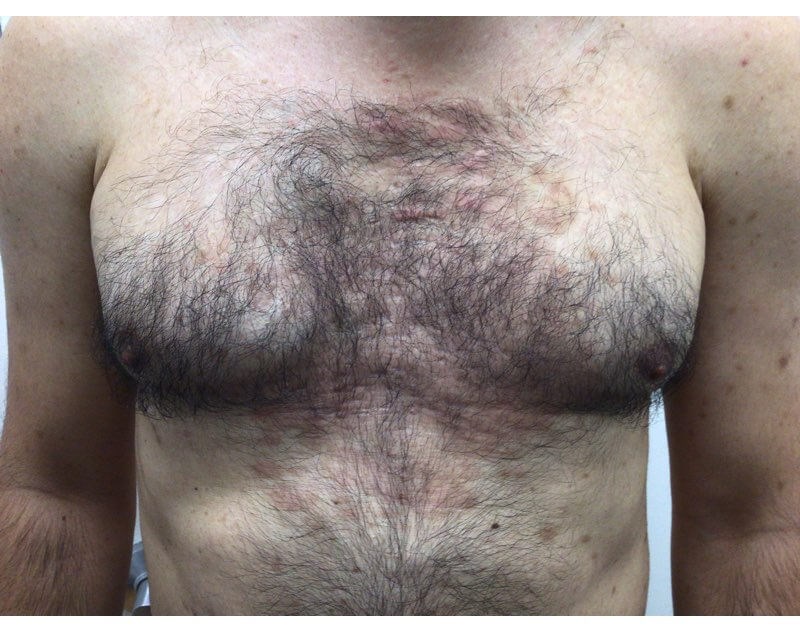 After Image