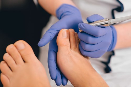 Onychomycosis