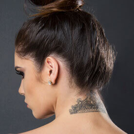 Laser Tattoo Removal
