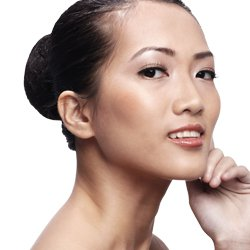 Vitiligo