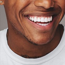 Tooth-Colored Fillings