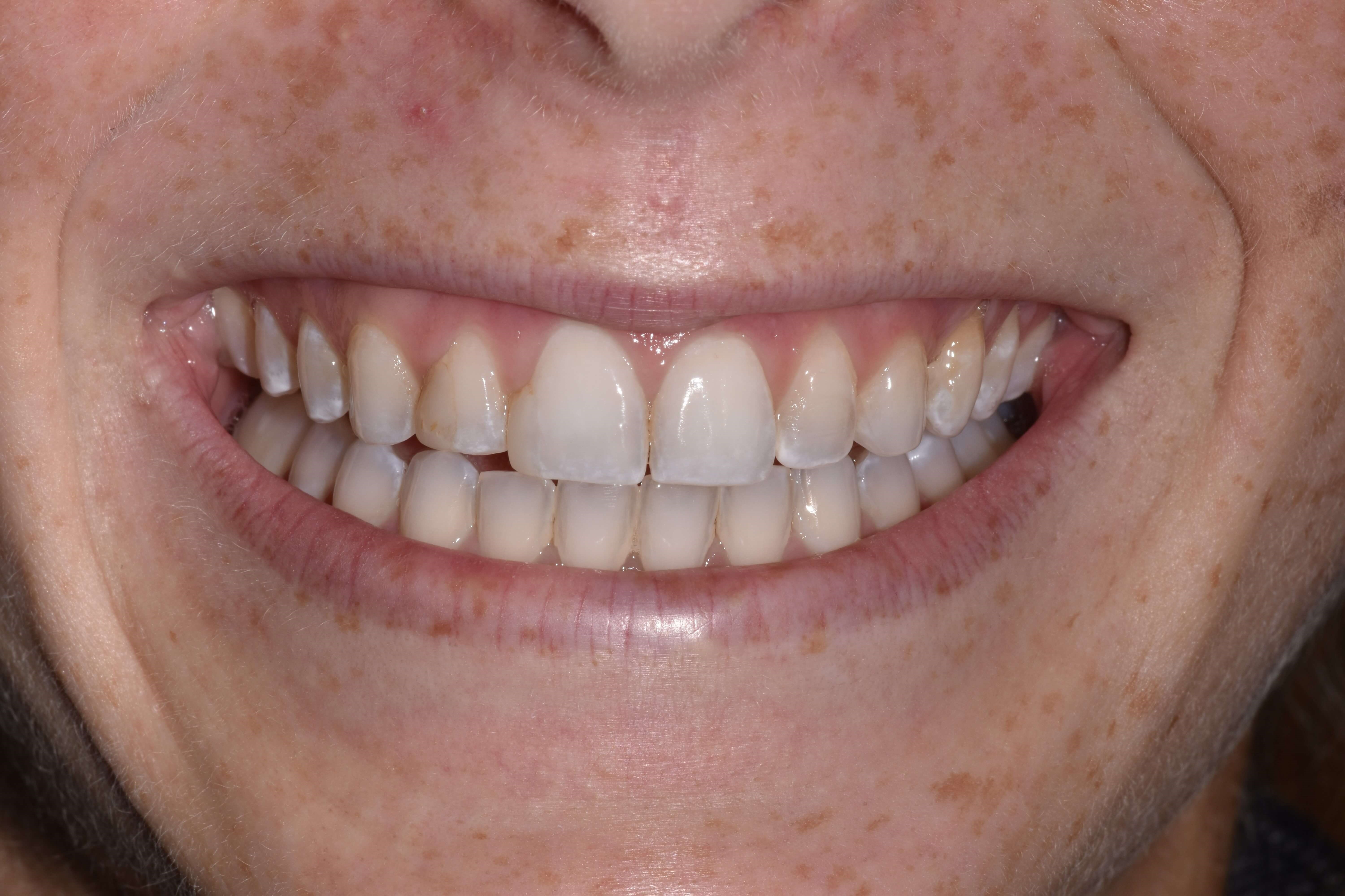Before Image