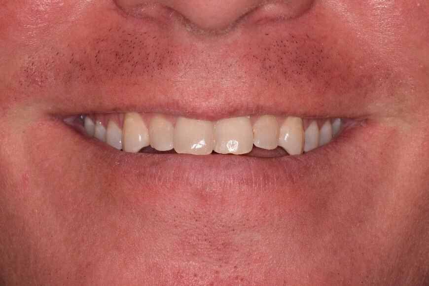 Before Image