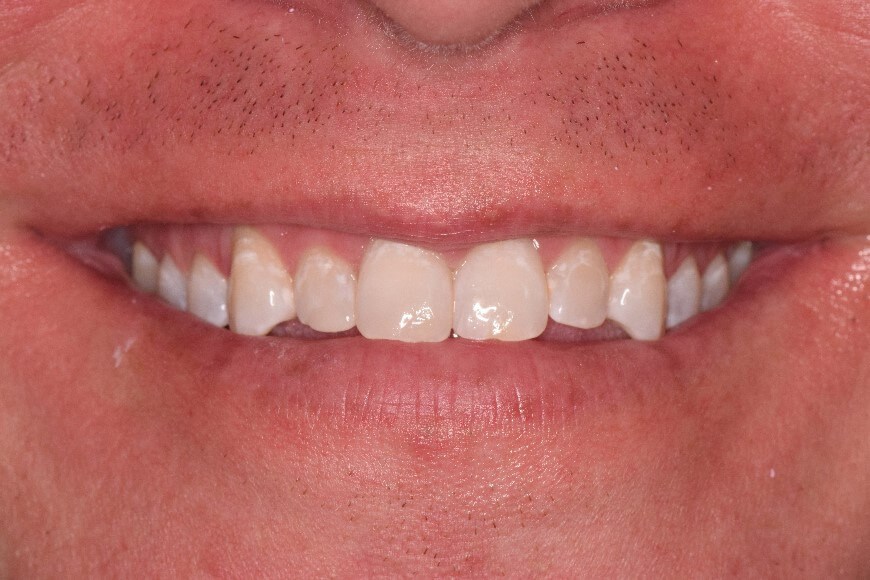 After Image