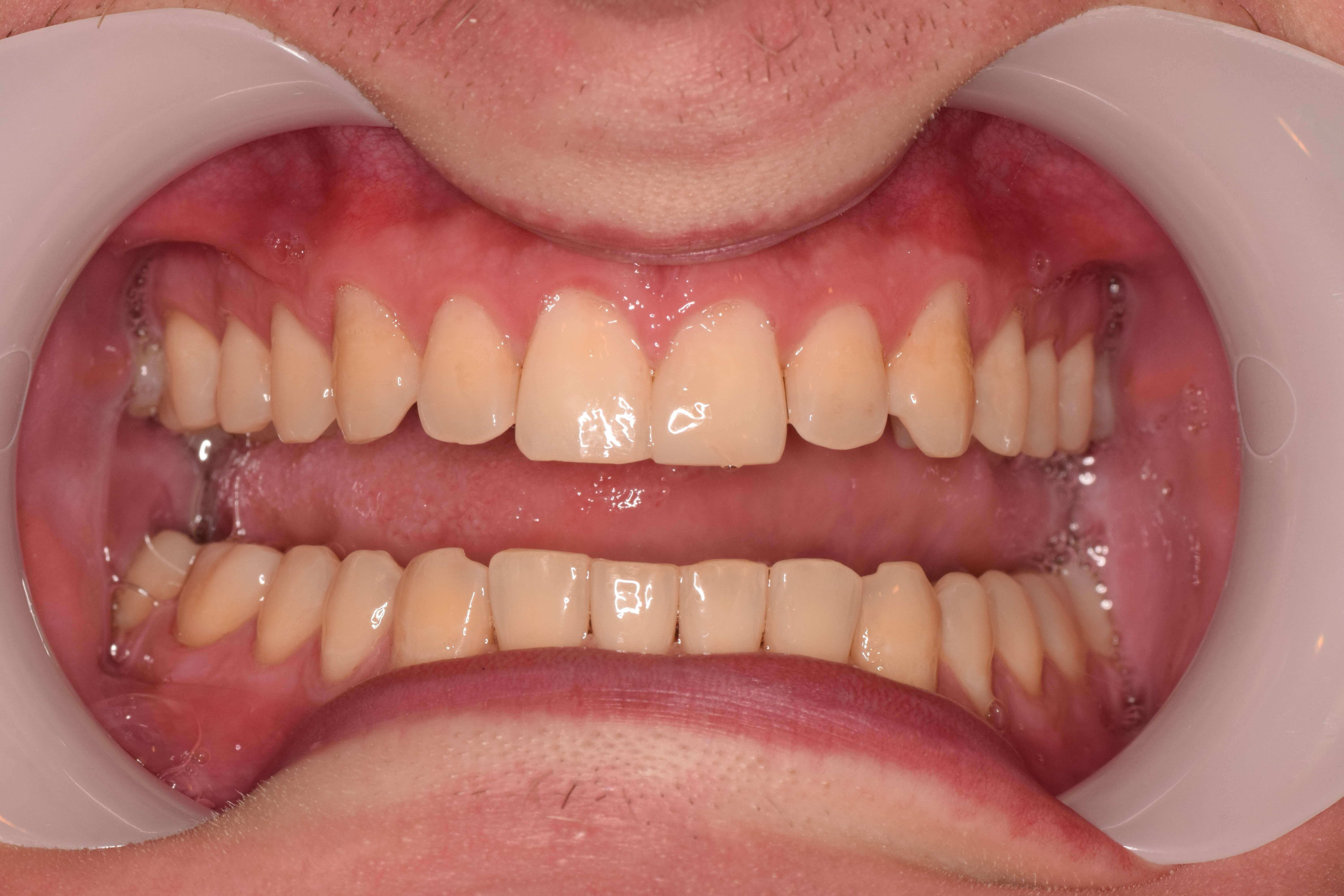 After Image