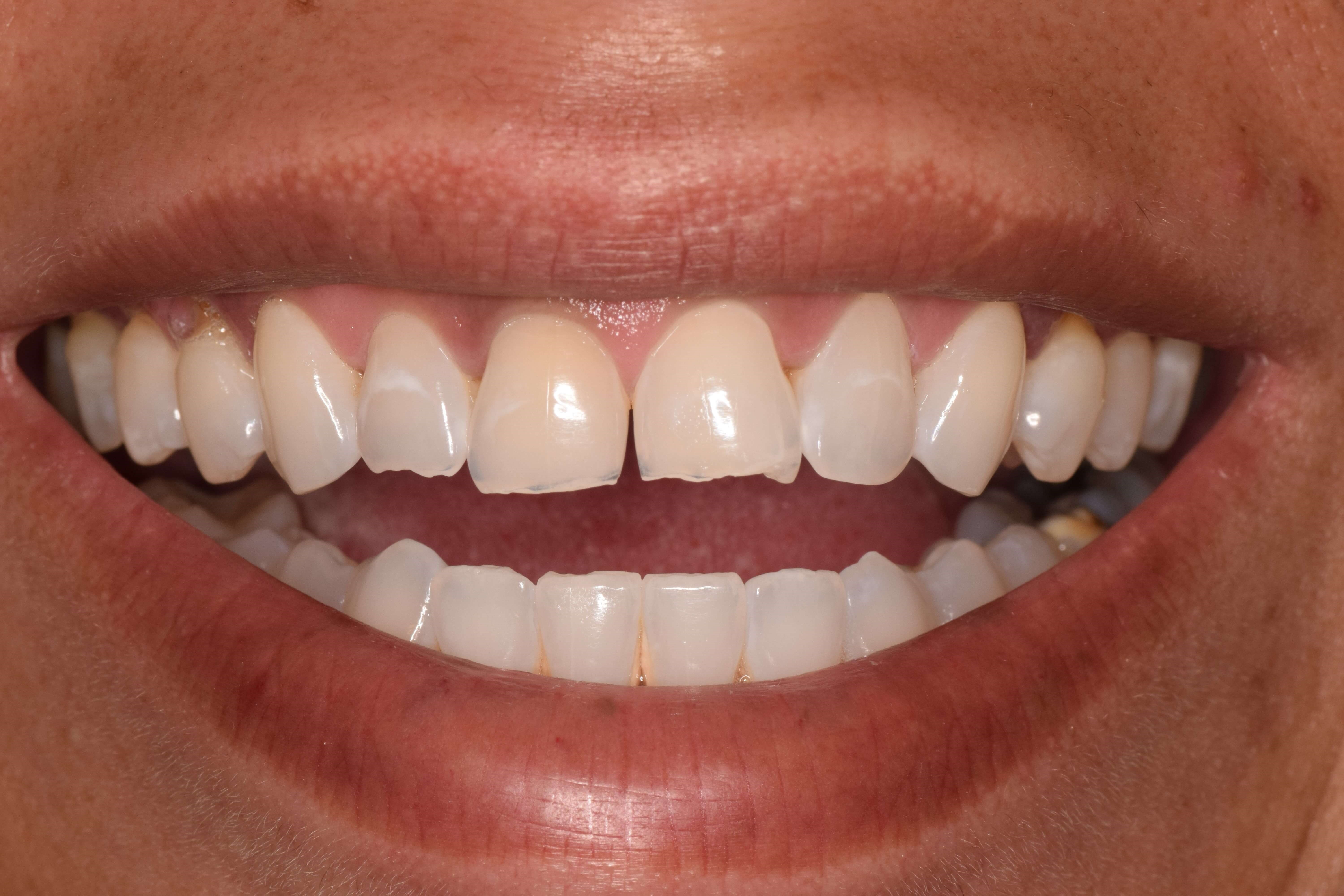 Before Image