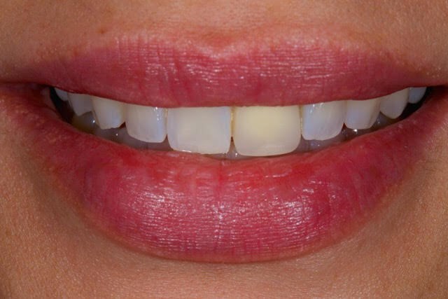 Before Image