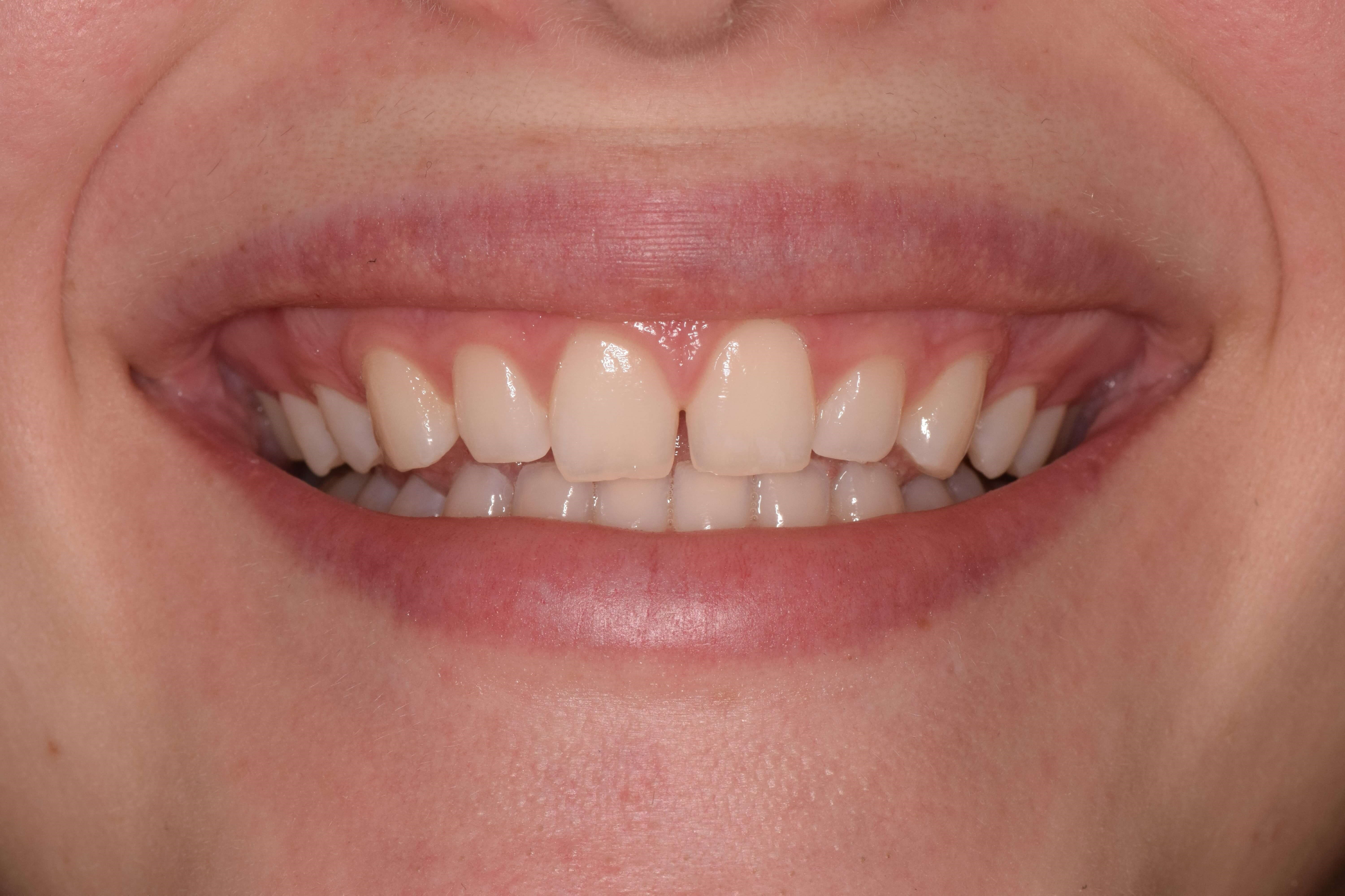Before Image