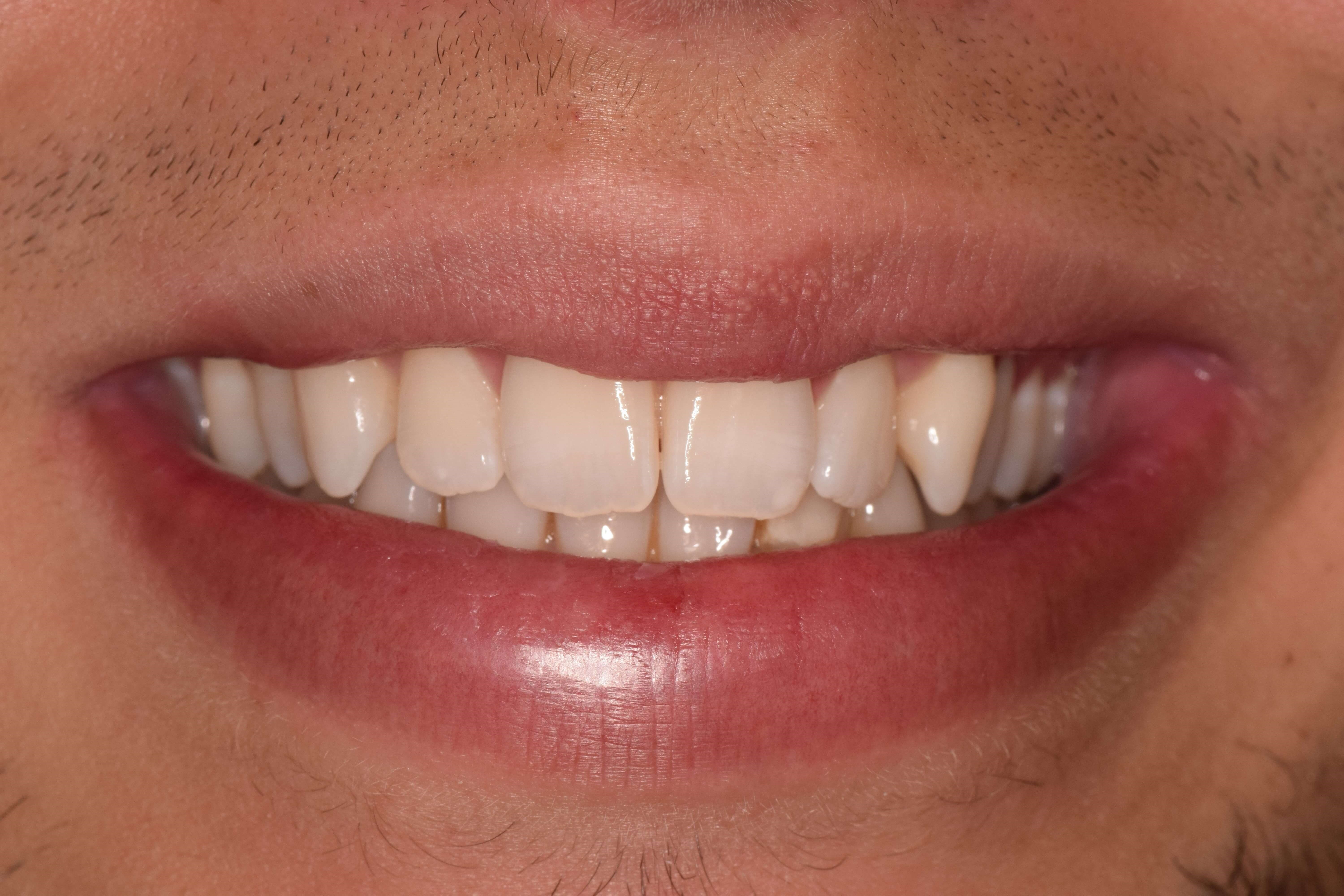 Before Image
